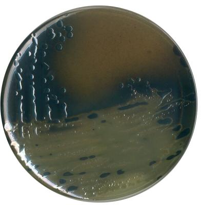 Агар висмут-сульфитный по Вильсону-Блэру  для выделения и дифференциации Salmonella typhi 1054180500