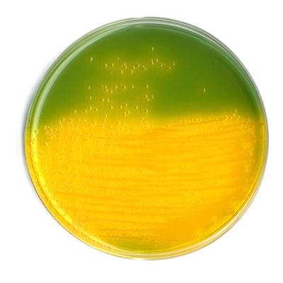 Агар TCBS  для выделения и селективного культивирования Vibrio cholera 1102630500